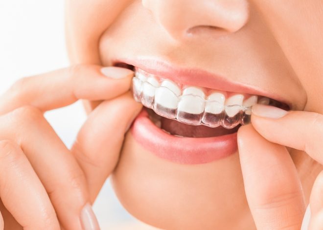 Achieving a Beautiful Smile: How Invisalign Can Help