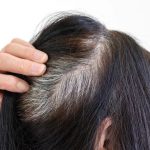 Wellhealthorganic.com: know-the-causes-of-white-hair-and-easy-ways-to-prevent-it-naturally