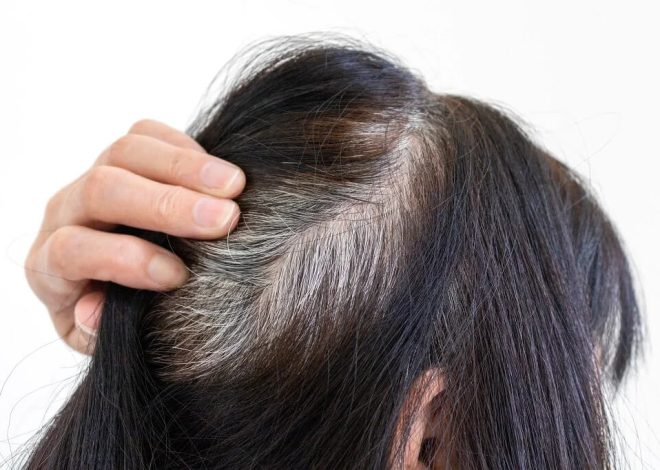 Wellhealthorganic.com: know-the-causes-of-white-hair-and-easy-ways-to-prevent-it-naturally