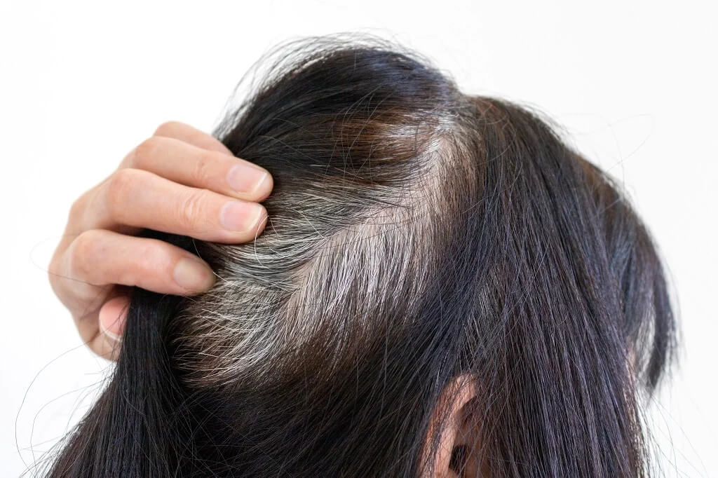 Wellhealthorganic.com: know-the-causes-of-white-hair-and-easy-ways-to-prevent-it-naturally